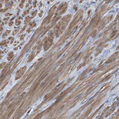 Immunohistochemistry-Paraffin: GlyT1/SLC6A9 Antibody [NBP1-81820]