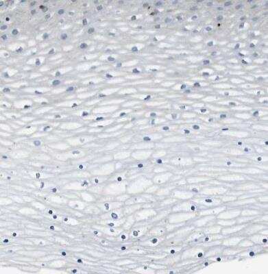 Immunohistochemistry-Paraffin: GlyT1/SLC6A9 Antibody [NBP1-81820]