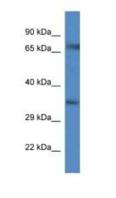 Western Blot: GlyT1/SLC6A9 Antibody [NBP1-74187]