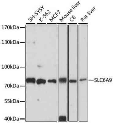 Western Blot: GlyT1/SLC6A9 AntibodyAzide and BSA Free [NBP3-03237]