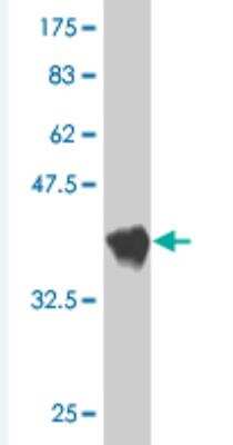 Western Blot: GlyT2/SLC6A5 Antibody (3B3) [H00009152-M01]