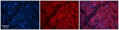 Immunohistochemistry-Paraffin: GlyT2/SLC6A5 Antibody [NBP2-86653]