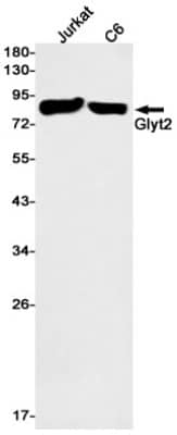 Western Blot: GlyT2/SLC6A5 Antibody (S08-1A3) [NBP3-19648]