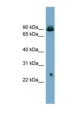 Western Blot: GlyT2/SLC6A5 Antibody [NBP1-59657]