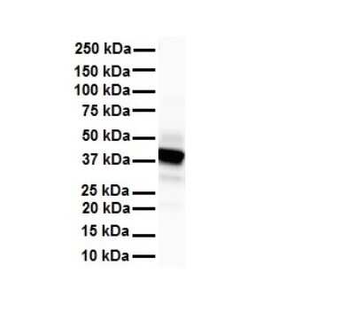 Western Blot: GlyT2/SLC6A5 Antibody [NBP2-86653]