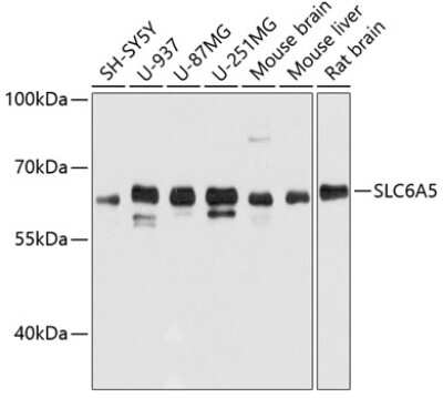 Western Blot: GlyT2/SLC6A5 AntibodyAzide and BSA Free [NBP3-03334]