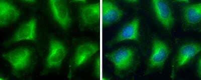 Immunocytochemistry/ Immunofluorescence: Glycerol 3 Phosphate Dehydrogenase Antibody [NBP2-16688]