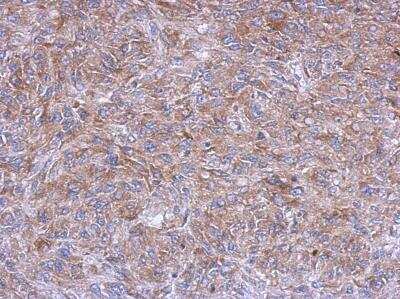 Immunohistochemistry-Paraffin: Glycerol 3 Phosphate Dehydrogenase Antibody [NBP2-16688]