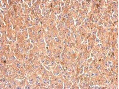 Immunohistochemistry-Paraffin: Glycerol 3 Phosphate Dehydrogenase Antibody [NBP2-16688]