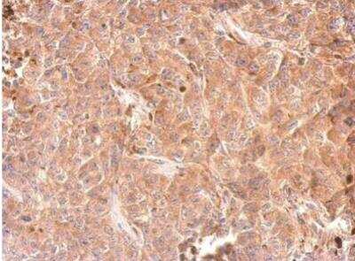 Immunohistochemistry-Paraffin: Glycerol 3 Phosphate Dehydrogenase Antibody [NBP2-16688]