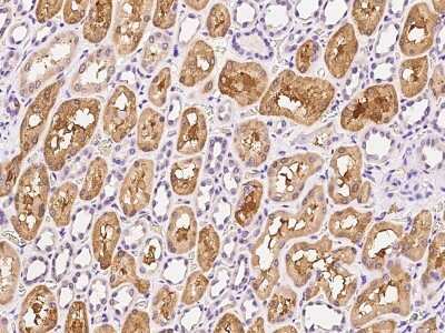 Immunohistochemistry-Paraffin: Glycerol 3 Phosphate Dehydrogenase Antibody [NBP2-99489]