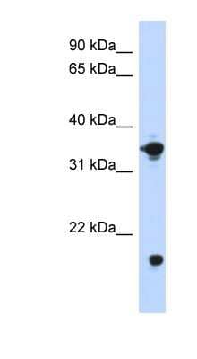 Western Blot: Glycerol 3 Phosphate Dehydrogenase Antibody [NBP1-55332]