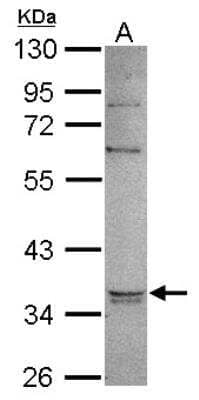 Western Blot: Glycerol 3 Phosphate Dehydrogenase Antibody [NBP2-16688]