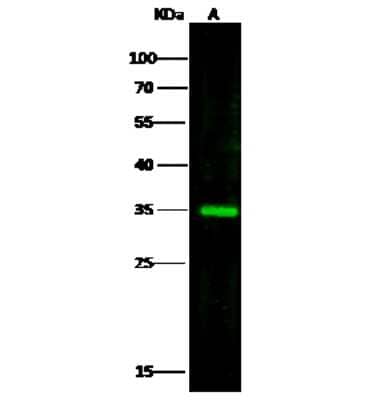 Western Blot: Glycerol 3 Phosphate Dehydrogenase Antibody [NBP2-97069]