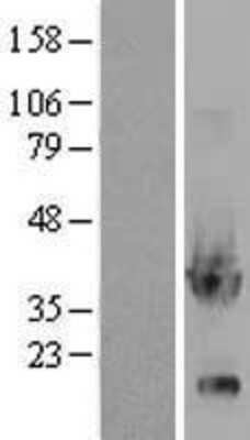 Western Blot: Glycerol 3 Phosphate Dehydrogenase Overexpression Lysate [NBL1-11224]