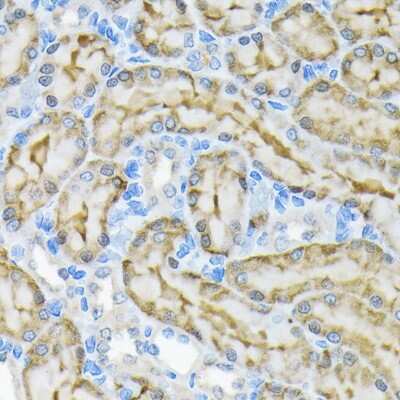 Immunohistochemistry-Paraffin: Glycerol Kinase Antibody (8S4T8) [NBP3-15687]