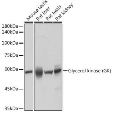 Western Blot: Glycerol Kinase Antibody (8S4T8) [NBP3-15687]