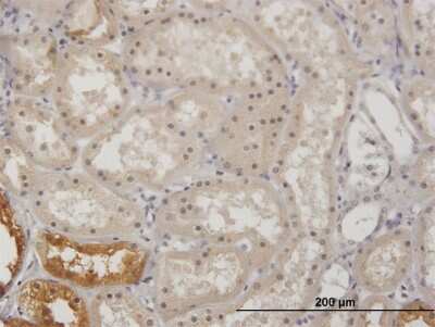 Immunohistochemistry-Paraffin: Glycerol Kinase Antibody [H00002710-B01P]