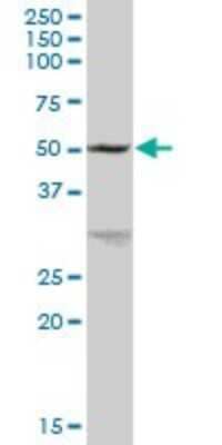 Western Blot: Glycerol Kinase Antibody [H00002710-B01P]