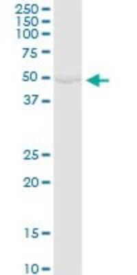 Western Blot: Glycerol Kinase Antibody [H00002710-D01P]