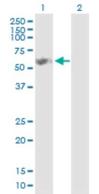Western Blot: Glycerol Kinase Antibody [H00002710-D01P]