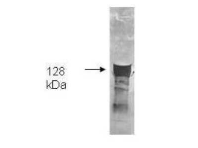 Western Blot: Glycerol Kinase Antibody [NBP1-78018]