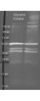 Western Blot: Glycerol Kinase Antibody [NBP1-78018]