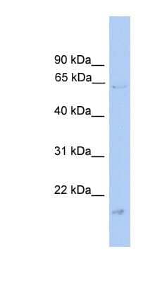 Western Blot: Glycerol Kinase Antibody [NBP1-57033]