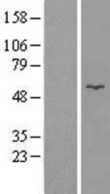 Western Blot: Glycerol Kinase Overexpression Lysate [NBL1-11101]