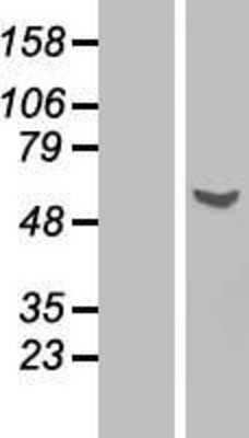 Western Blot: Glycerol Kinase Overexpression Lysate [NBP2-11150]