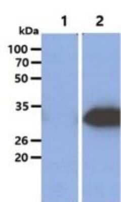 Western Blot: Glycine N-Methyltransferase/GNMT Antibody (5D1)BSA Free [NBP2-59452]