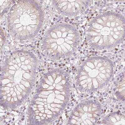 Immunohistochemistry-Paraffin: Glycine N-Methyltransferase/GNMT Antibody [NBP1-89512]