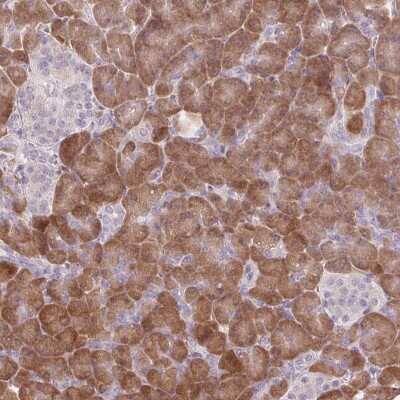 Immunohistochemistry-Paraffin: Glycine N-Methyltransferase/GNMT Antibody [NBP1-89512]