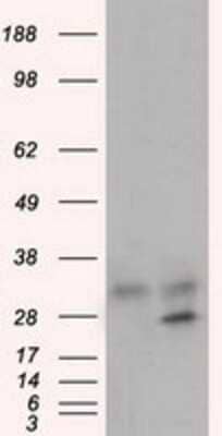 Western Blot: Glycine N-Methyltransferase/GNMT Antibody (OTI8A3)Azide and BSA Free [NBP2-71838]