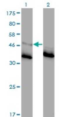 Western Blot: Glycine Receptor Alpha 1 Antibody (2E6) [H00002741-M01]