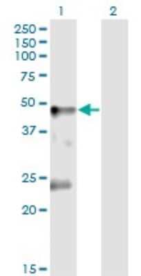 Western Blot: Glycine Receptor Alpha 1 Antibody (2E7) [H00002741-M02]