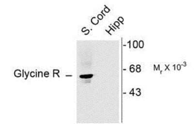 Western Blot: Glycine Receptor Alpha 1 AntibodyAzide and BSA Free [NB300-113]