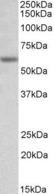 Western Blot: Glycine Receptor Alpha 1 Antibody [NBP2-26171]