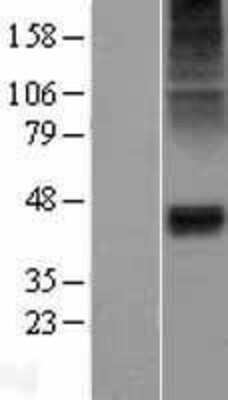 Western Blot: Glycine Receptor Alpha 1 Overexpression Lysate [NBP2-04151]