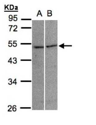 Western Blot: Glycine Receptor alpha 3 Antibody [NBP1-30930]