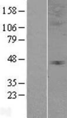 Western Blot: Glycine Receptor alpha 3 Overexpression Lysate [NBP2-04313]