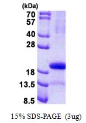 SDS-PAGE: Recombinant Human PP14/Glycodelin His Protein [NBP2-23363]