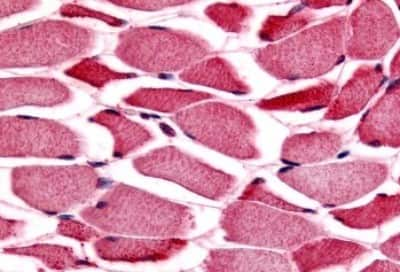 Immunohistochemistry-Paraffin: Glycogen phosphorylase, muscle form Antibody [NBP3-14337]