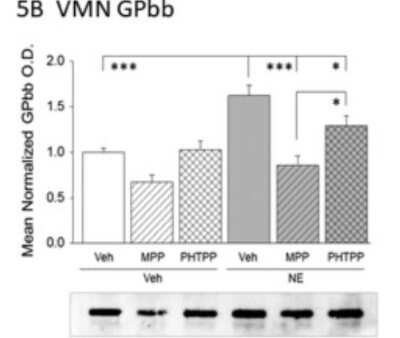 Western Blot: Glycogen Phosphorylase BB/GPBB Antibody [NBP1-32799]