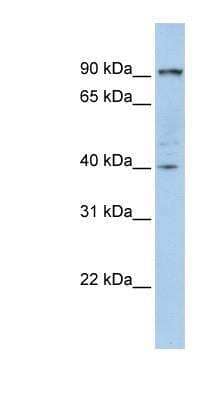 Western Blot: Glycogen Phosphorylase BB/GPBB Antibody [NBP1-54940]