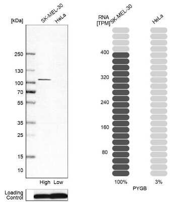 Western Blot: Glycogen Phosphorylase BB/GPBB Antibody [NBP2-47446]