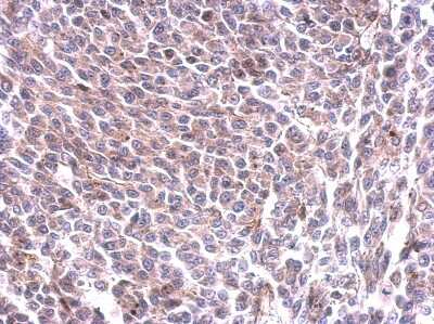 Immunohistochemistry-Paraffin: Glycogen Synthase Antibody [NBP2-16690]