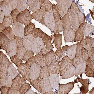 Immunohistochemistry-Paraffin: Glycogen Synthase Antibody [NBP2-34071]