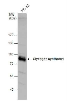 Western Blot: Glycogen Synthase Antibody [NBP2-16690]