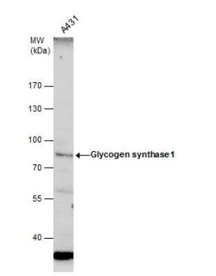 Western Blot: Glycogen Synthase Antibody [NBP2-16690]